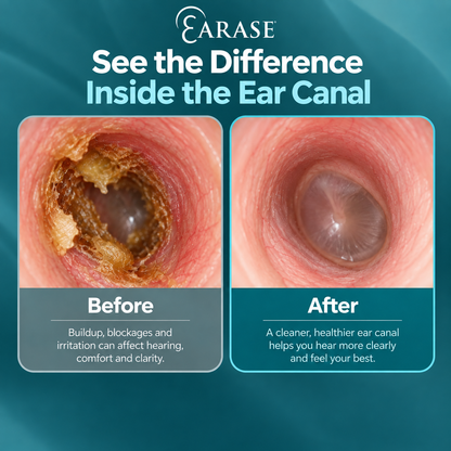 Earase Ear Drops